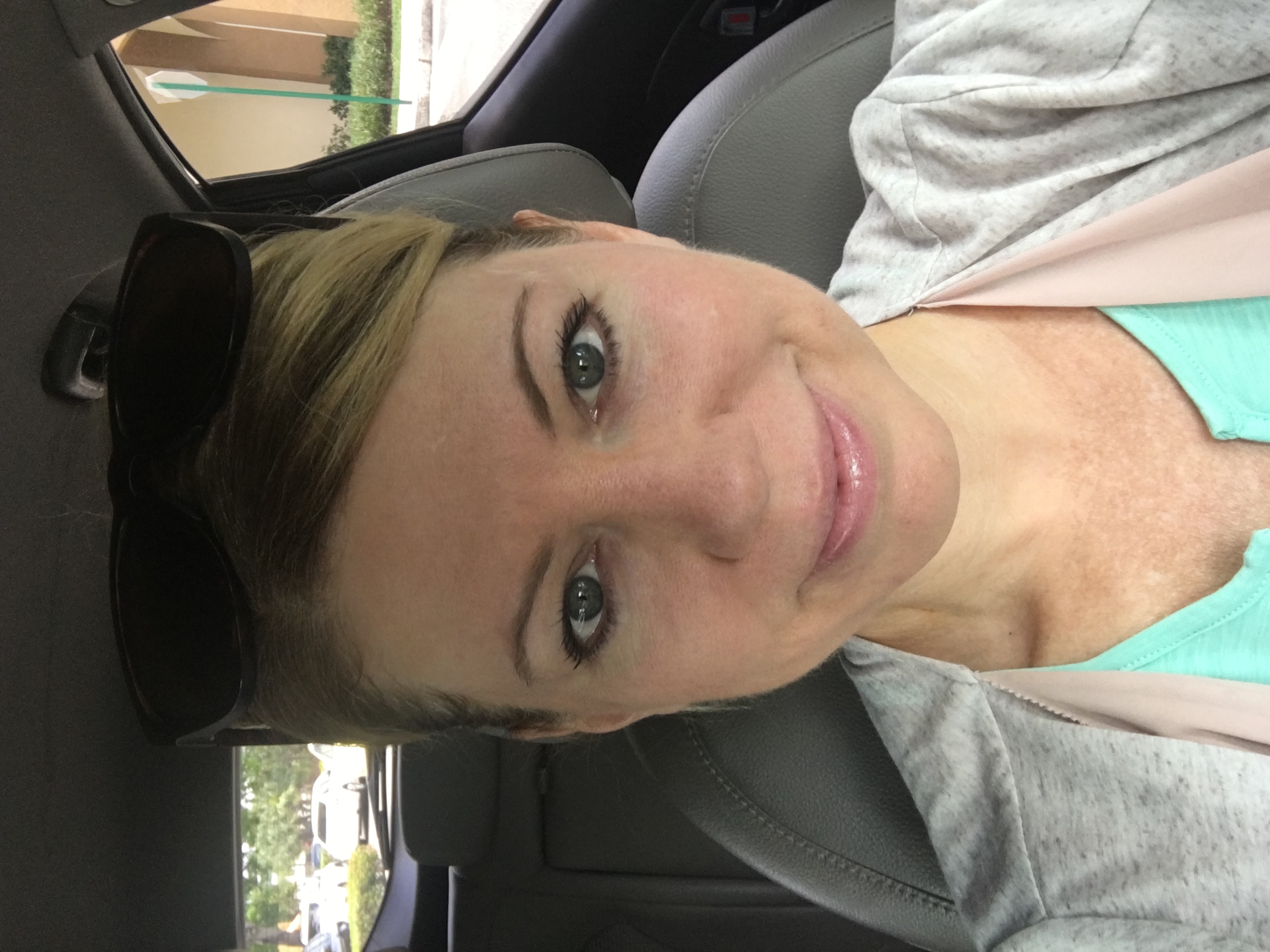 Microdermabrasion Vs Microneedling Vs Dermaplaning Results Womens 