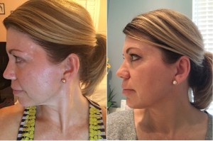 Image Skincare before and after photo