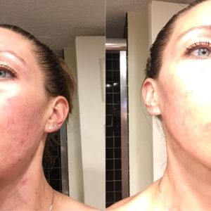 Beautycounter Countercontrol review