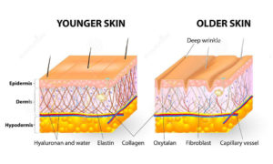 Retinol increases elastin