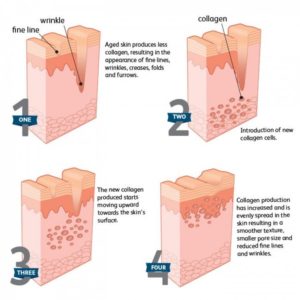 How to build collagen in skin