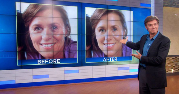 Dr Oz Before and After