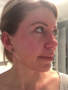 Juice Beauty Green Apple Peel results